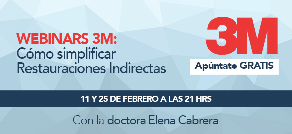 Webinars: Como simplificar a Restauração Indirecta?