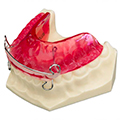 Activateurs d'orthodontie
