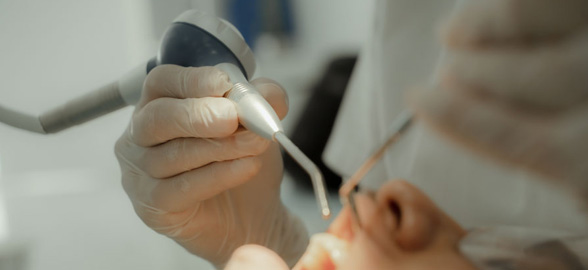 Aeropulitori Dentali: scegli il migliore per la tua clinica