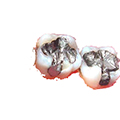 Amálgama Dental
