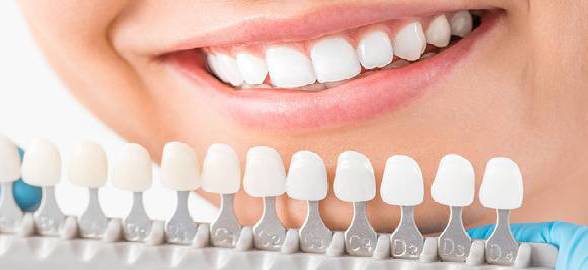 Aggiornamento essenziale sui Trattamenti di Sbiancamento Dentale