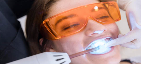 Curso Online: Blanqueamientos Dentales (Video completo)