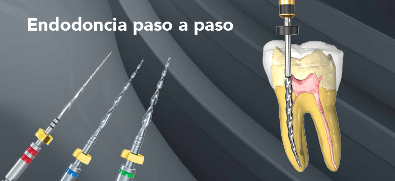 Prodotti per ogni fase del trattamento endodontico