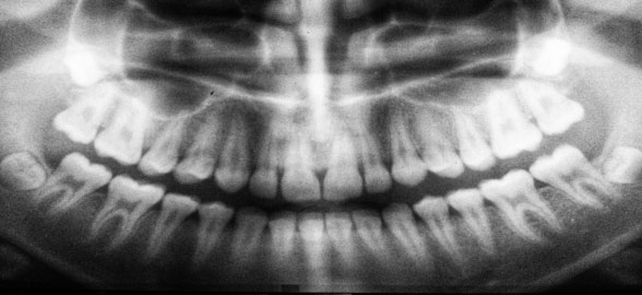 I 9 problemi più comuni nelle radiografie e come evitarli