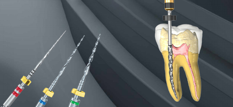 Tips for successful endodontic treatments.