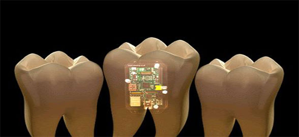 Los chips dentales: ¿para qué sirven y como pueden ayudar a mejorar la salud bucal?