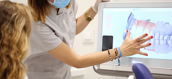 Scansione intraorale: Come può essere d'aiuto nella vostra clinica odontoiatrica?