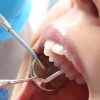 Exploração e Diagnóstico Dentário