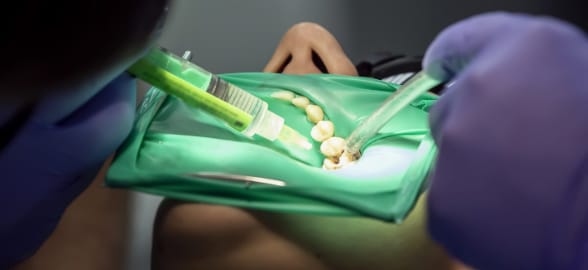 Learn all about irrigant solutions in endodontics: A complete guide for dental professionals