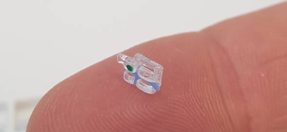 Apparecchi dentali in zaffiro, l'evoluzione