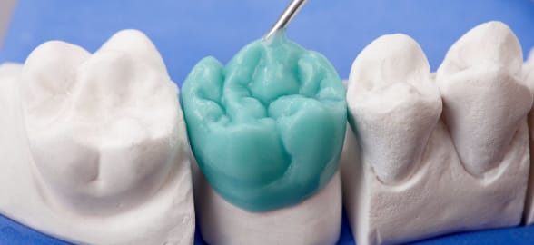 The ultimate guide to dental waxes