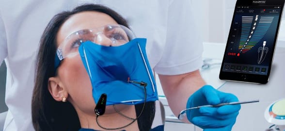 How the apical locator improves the efficiency of dental root canals