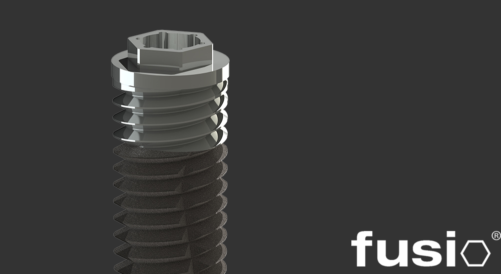 Implants Fusio de Connexion Externe
