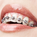 orthodontics