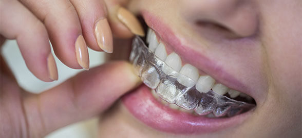 Planchas de termoformado dental: Tipos, usos y cómo elegir la ideal para tu clínica