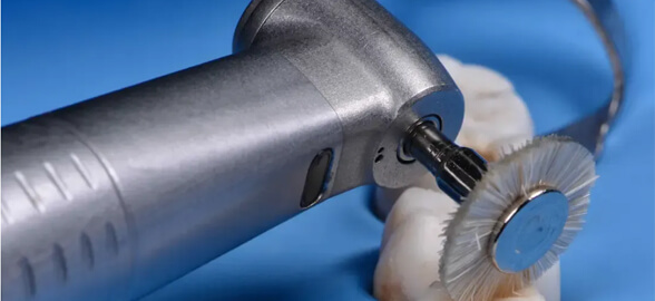 Dental Polishing Discs: Essential Tools for a Perfect Finish in Dentistry