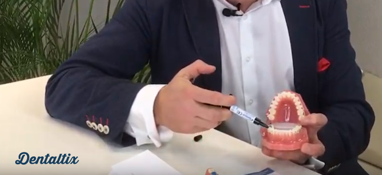 Come realizzare un prelievo di impronta dentale con il Cemento Resilience
