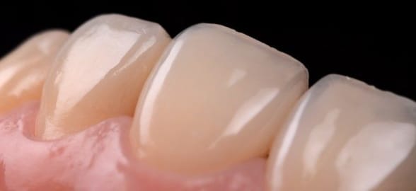 Complete Guide to Dental Composite Reconstruction for Dentists: Techniques, Materials, and Best Practices