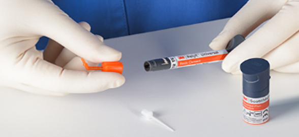 3M RelyX Universal: Simplifying dental cementation