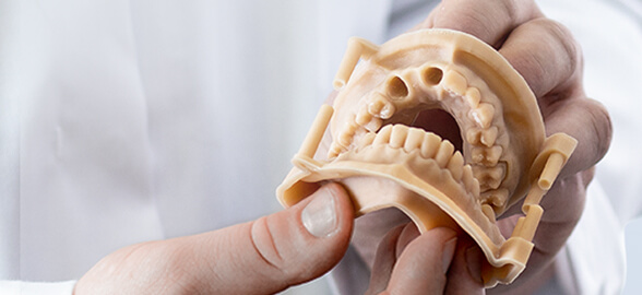 Résines de laboratoire dentaire : types, utilisation en dentisterie et progrès