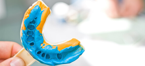 Guide complet sur les silicones par addition : la clé d'une empreinte précise