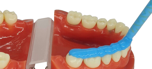 Tout sur l'enregistrement de l'occlusion avec de la silicone : utilisation et conseils pratiques