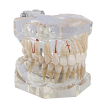 Macromodèle avec pathologie complète