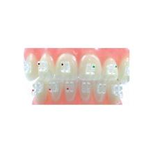 Sapphire Brackets (20 pcs)