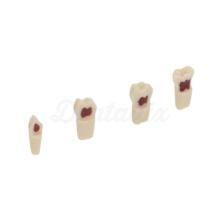 AK62Z: Modelo de Piezas Dentales Temporales para Preparaciones (10ud)