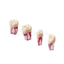 Endo Teeth for Practice