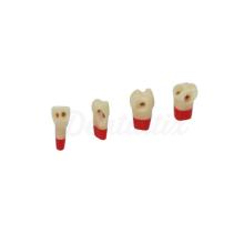 AG3ZSDPK.300V1: Pezzi dentali permanenti per preparazioni n. 24 (10ud)