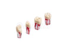 Denti endodontici trasparenti del Tipodonto ANA-4 (V)