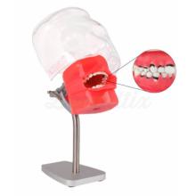 Fantoma de Periodontia de Mesa