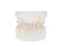 Modèle dentaire : Pratique de l'orthodontie