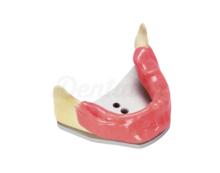 Modèle A-J KWA pour la Pratique en Implantologie (Mandibule d’Éxercices Implantologiques + Gencive Souple et Plaque de Montage)