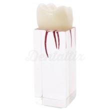 Molaire endodontique