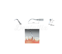 Ultrasound G-tips - Prophylaxis and Scarification
