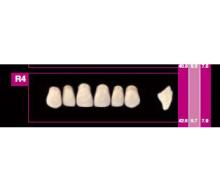 Cosmo HXL: Dientes Acrílicos Anteriores Superiores (6 uds)
