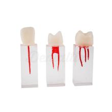 Set de Dentes Endo para Práticas