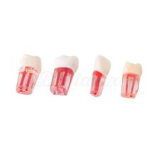 Jeu de dents transparentes avec conduits
