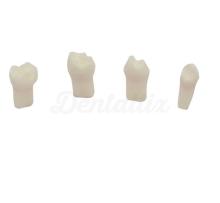 Pulpotomia pratica dei denti (4ud)