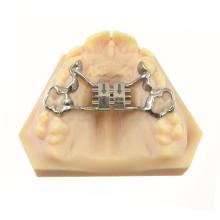Parafuso Expansor Rápido CAD-CAM Tooth Borne