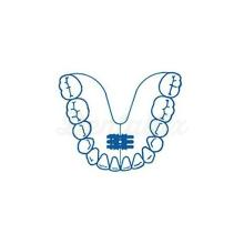 Standard Expansion Screw (10 pcs)